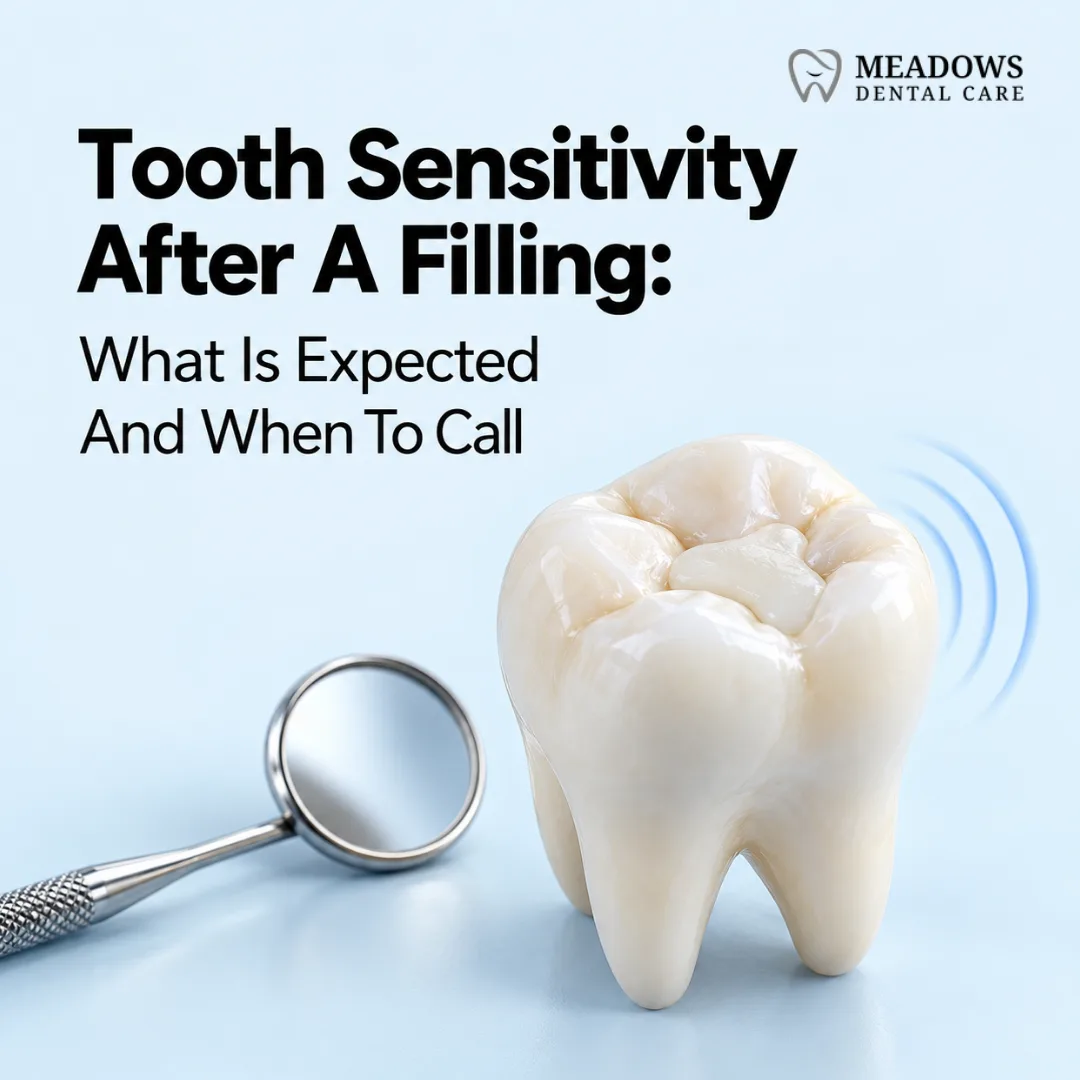 Tooth Sensitivity After a Filling: What Is Expected and When To Call